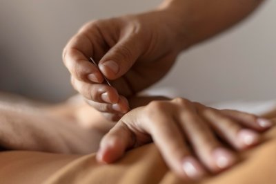 Wat is electro-acunpuctuur en wat moet je weten voor je eraan begint?